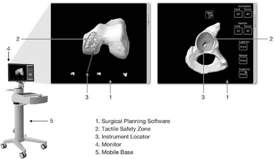 (GRAPHIC)