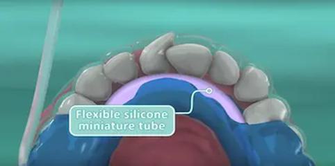 A model of teeth and gums Description automatically generated