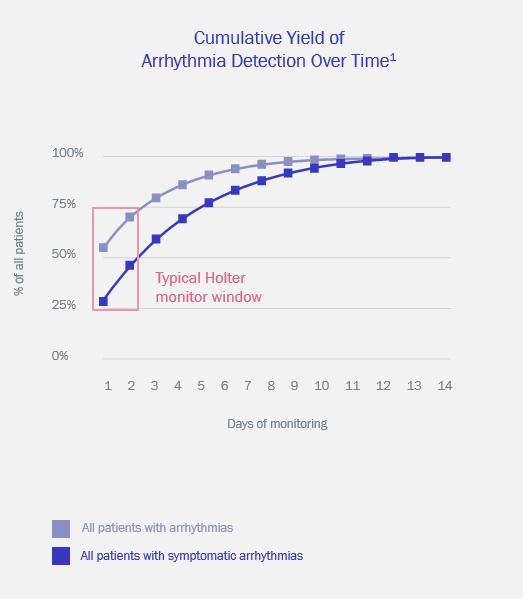 Arrythmia Detection Graph.jpg