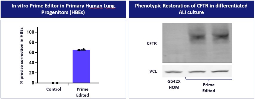 CFTR gene.jpg