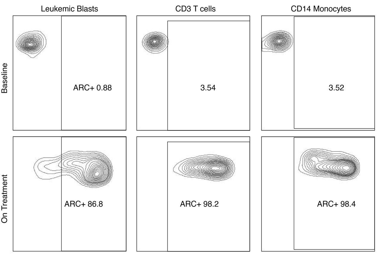 SL-172154 Binding to Leukemic Blasts.jpg