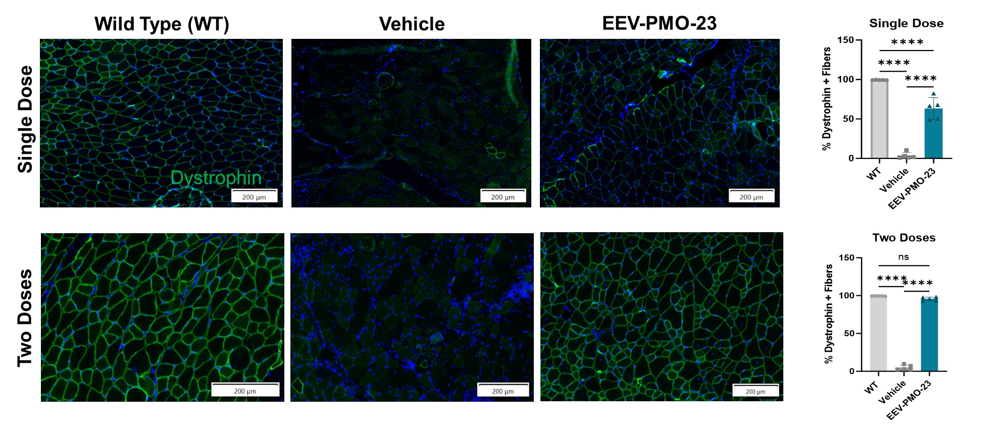 Dystrophin positive Fibers.jpg