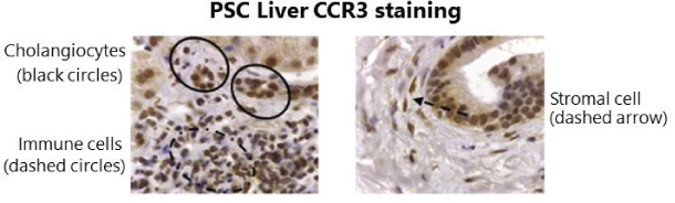 [MISSING IMAGE: tm211883d1-pht_biopsies4clr.jpg]