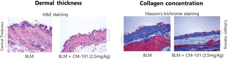 [MISSING IMAGE: tm211883d1-pht_dermal4clr.jpg]