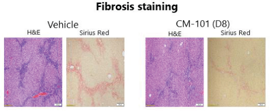 [MISSING IMAGE: tm211883d1-pht_fibrosis4clr.jpg]