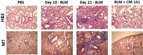 [MISSING IMAGE: tm211883d1-pht_inhibits4clr.jpg]