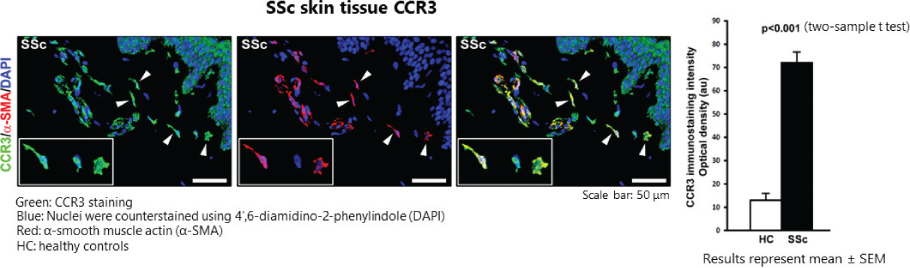 [MISSING IMAGE: tm211883d1-pht_skintise4clr.jpg]