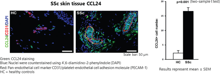 [MISSING IMAGE: tm211883d1-pht_tissue4clr.jpg]