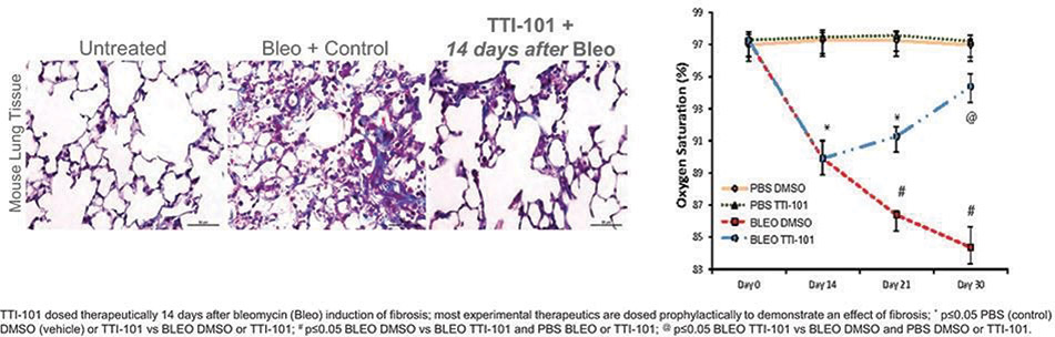 [MISSING IMAGE: fc_lungfibrosis-4clr.jpg]