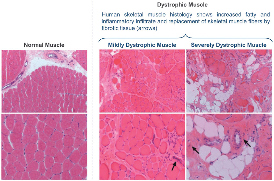 [MISSING IMAGE: tm2037601d3-ph_muscle4c.jpg]