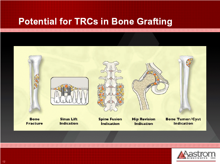 (BONE GRAFTING DIAGRAM)