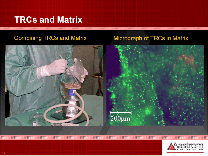 (TRCS AND MATRIX MICROGRAPH)