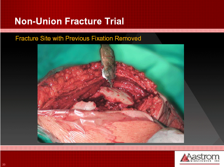 (NON-UNION FRACTURE TRIAL OPERATIONAL DIAGRAM)