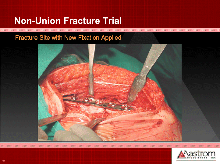 (NON-UNION FRACTURE TRIAL OPERATIONAL DIAGRAM)