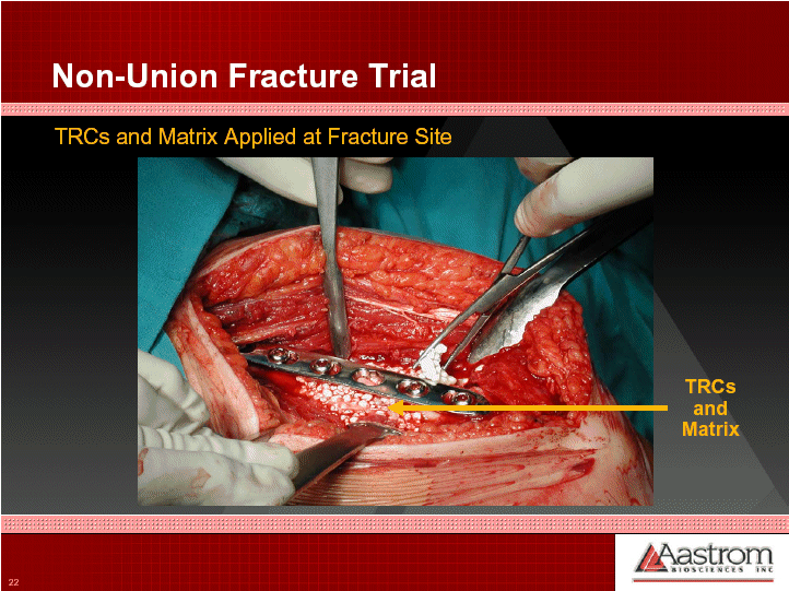 (NON-UNION FRACTURE TRIAL OPERATIONAL DIAGRAM)