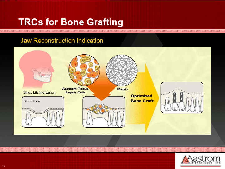 (JAW RECONSTRUCTION INDICATION STEPS)