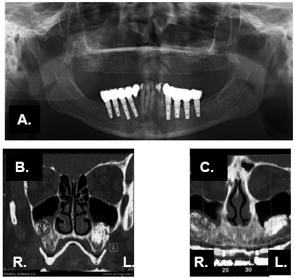 (XRAYS)