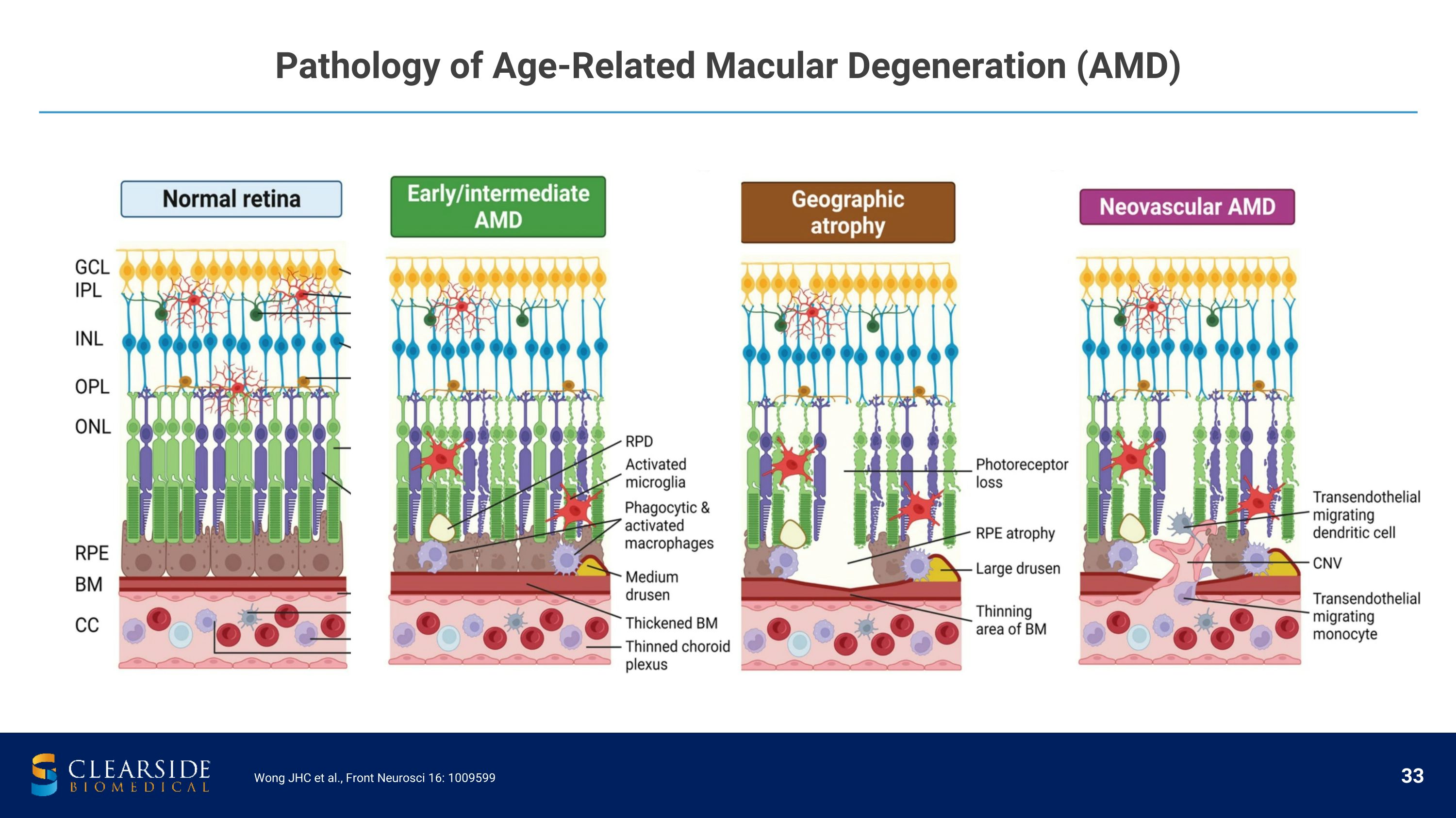 Slide 33