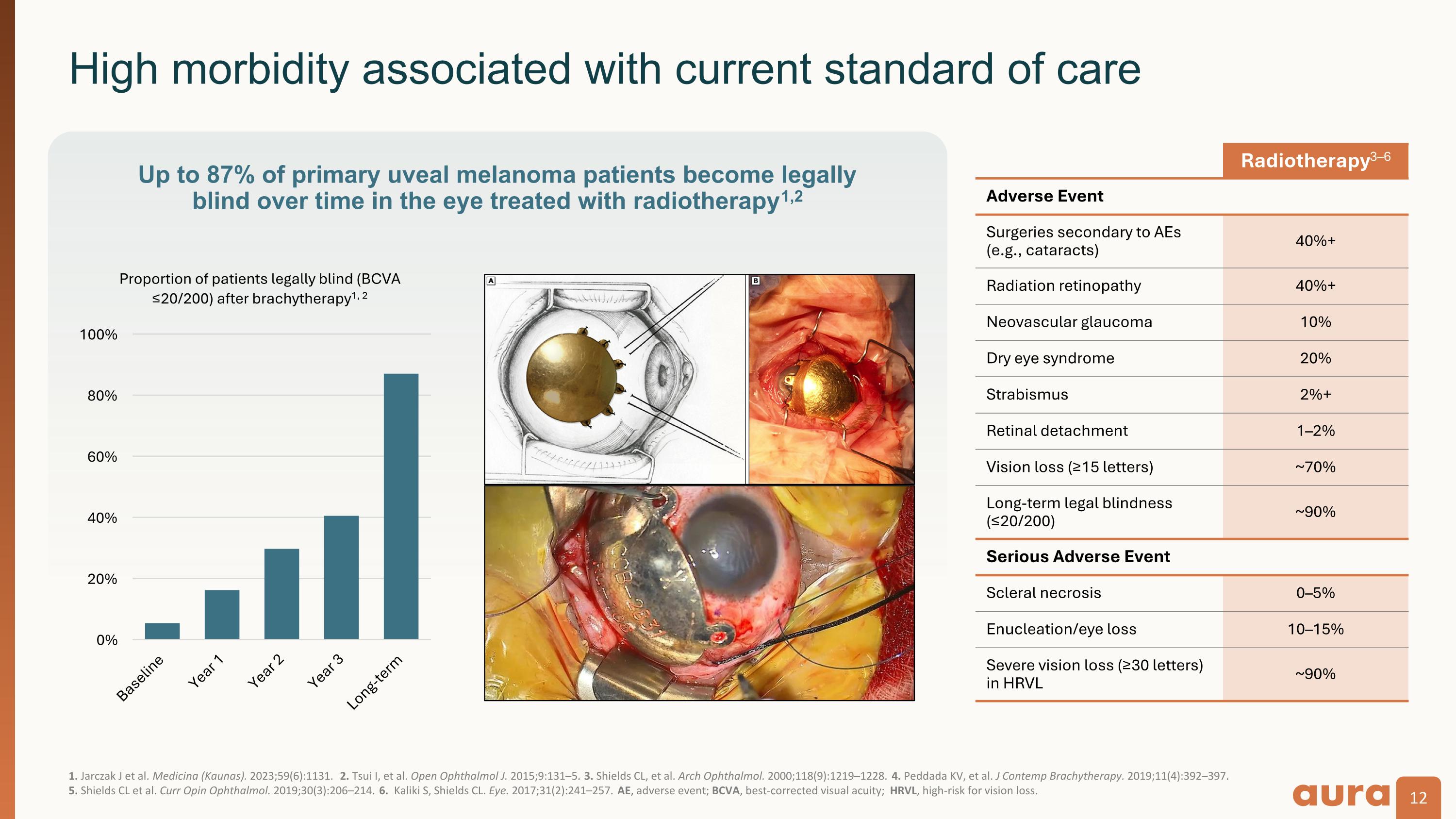 Slide 12