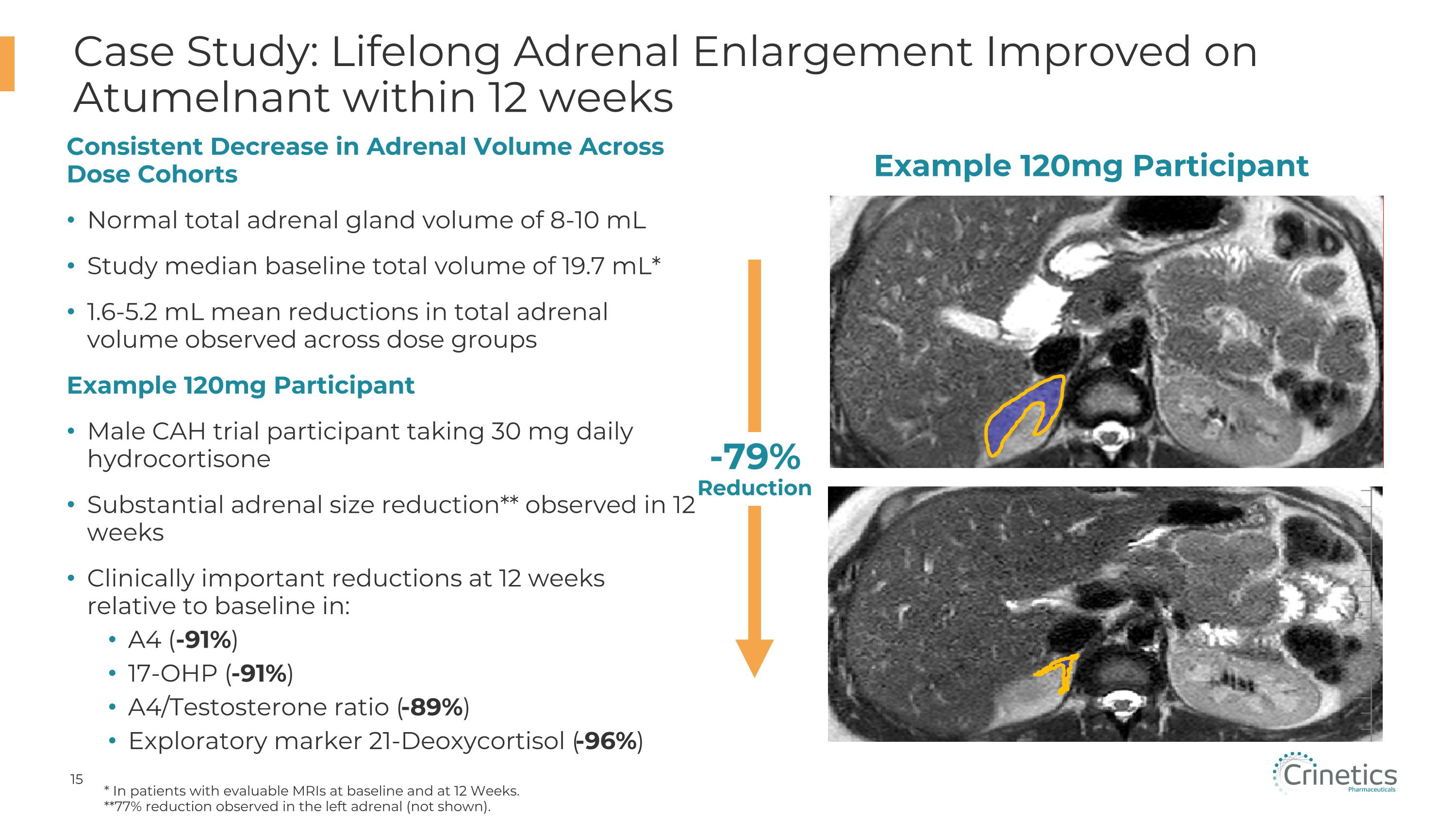 Slide 15