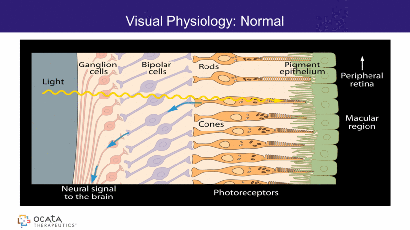 GRAPHIC