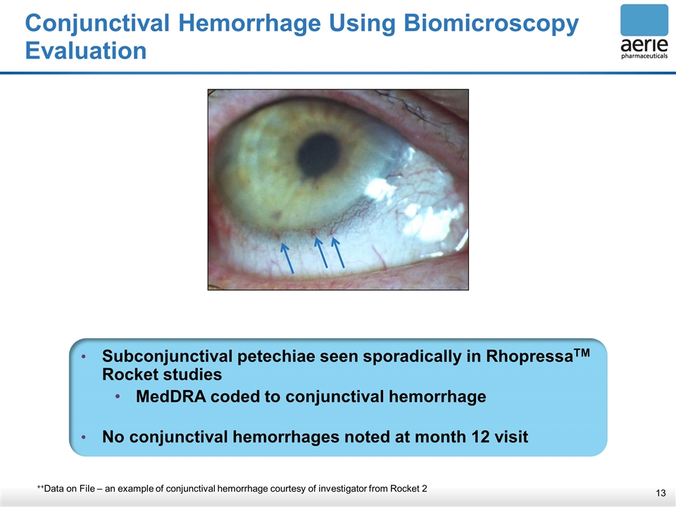 Slide 13