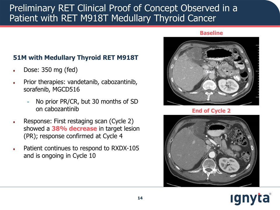 Slide 14