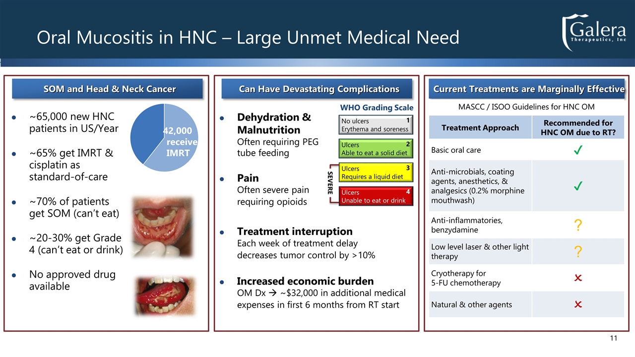 Slide 11