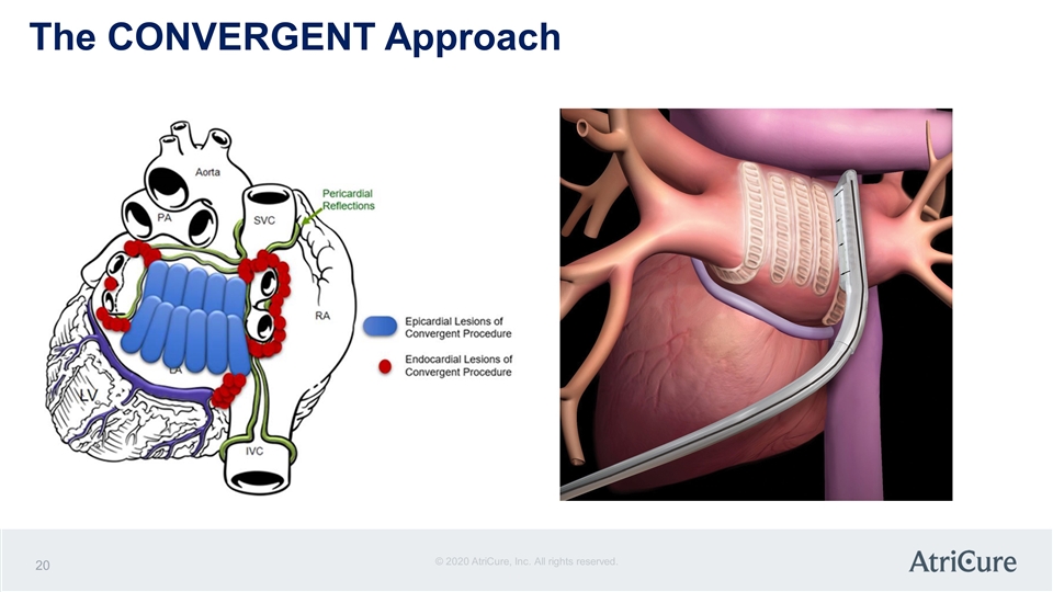 Slide 20