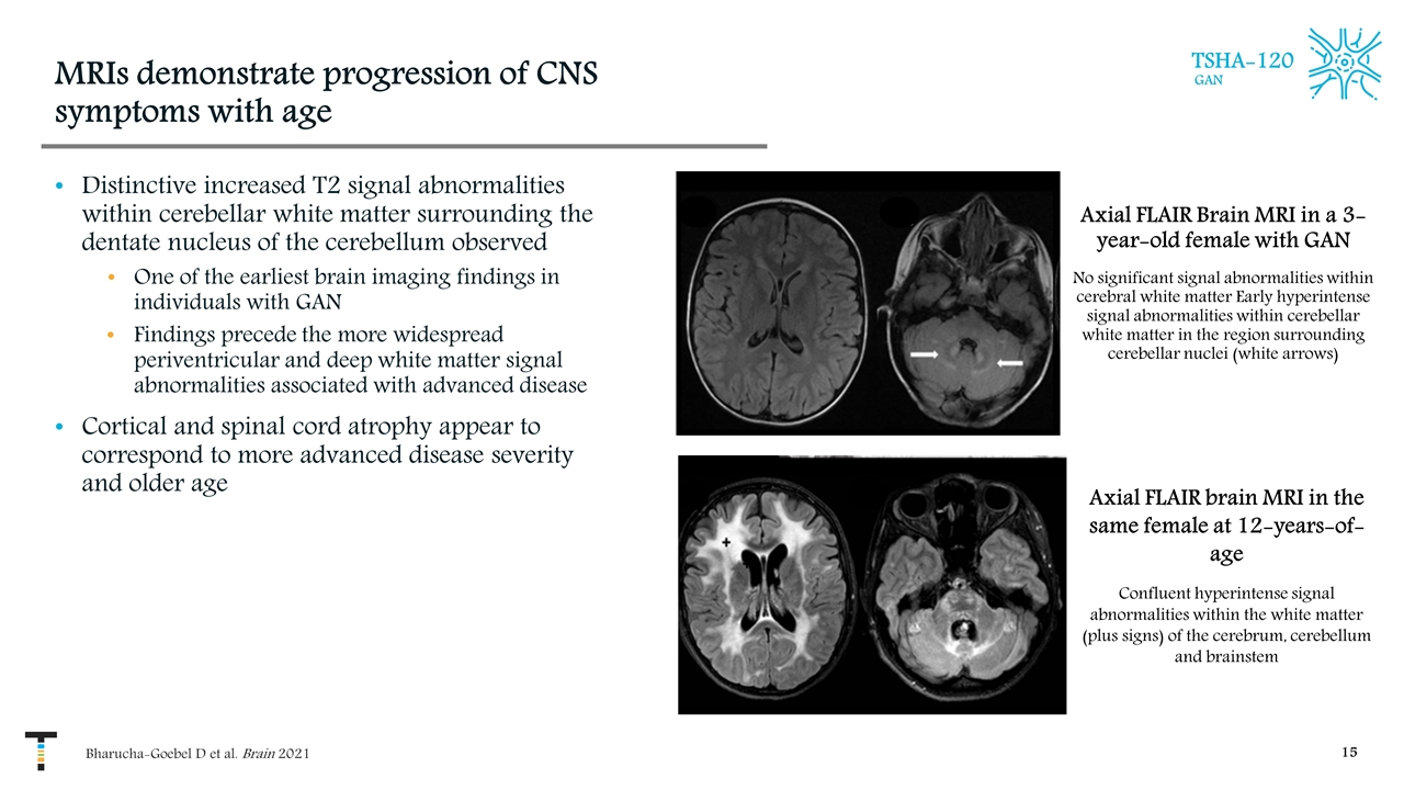 Slide 15