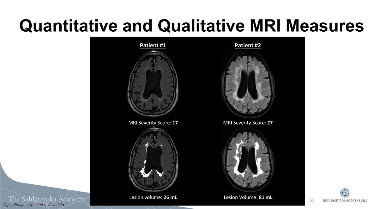 Slide 62