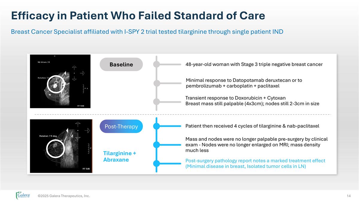 Slide 14