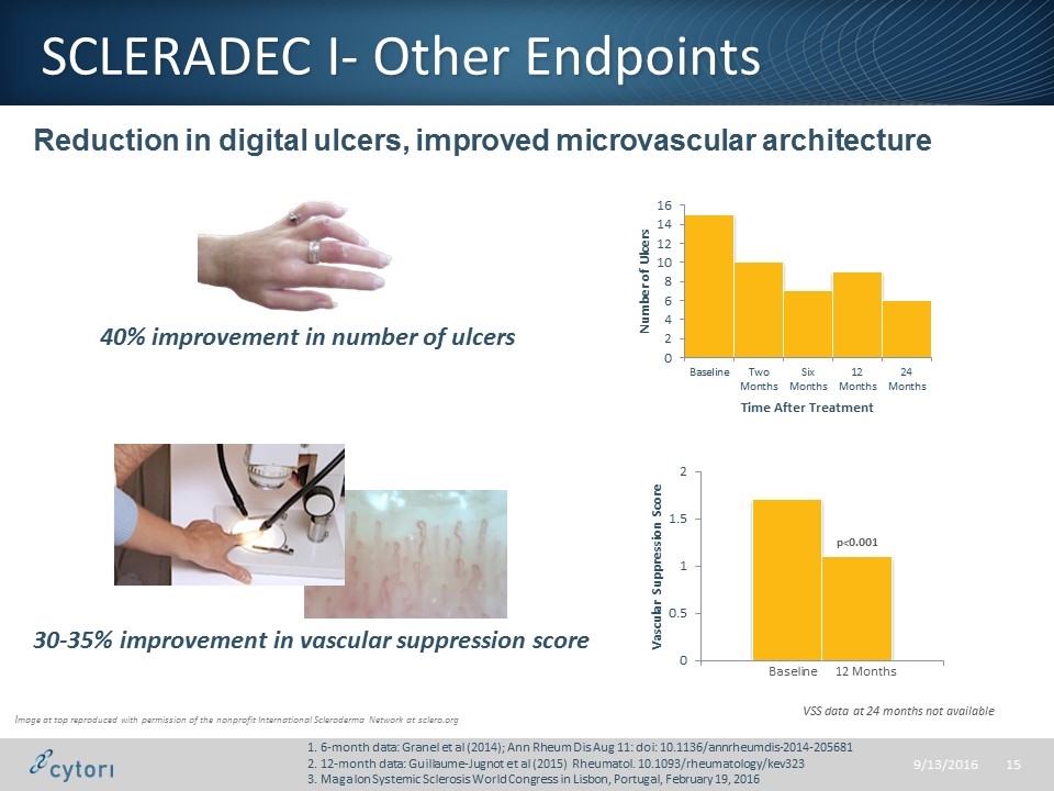 Slide 15