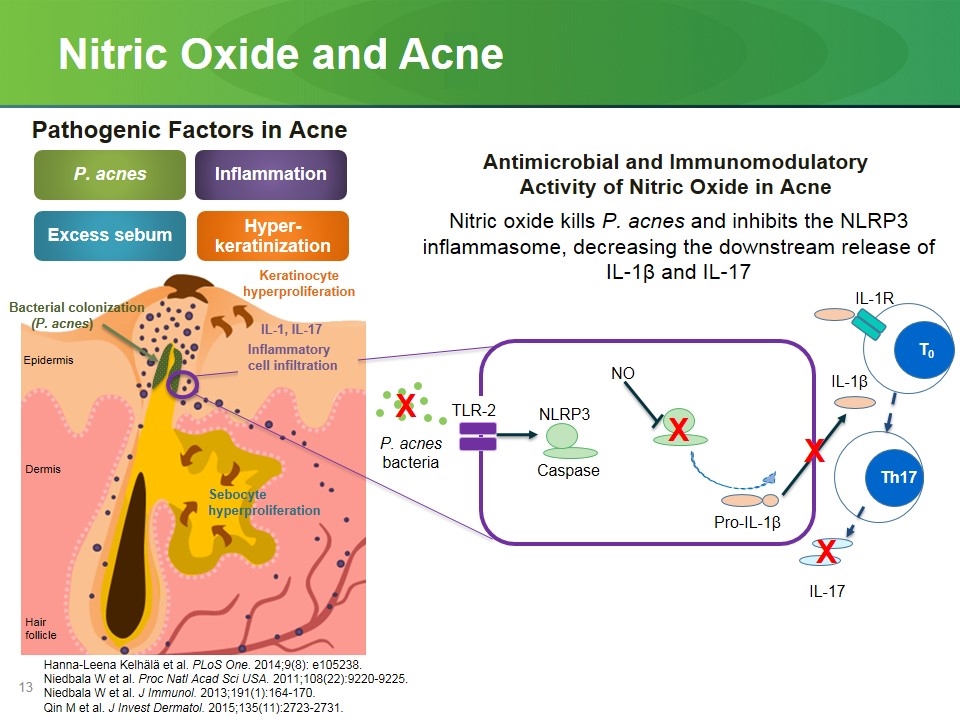 Slide 13