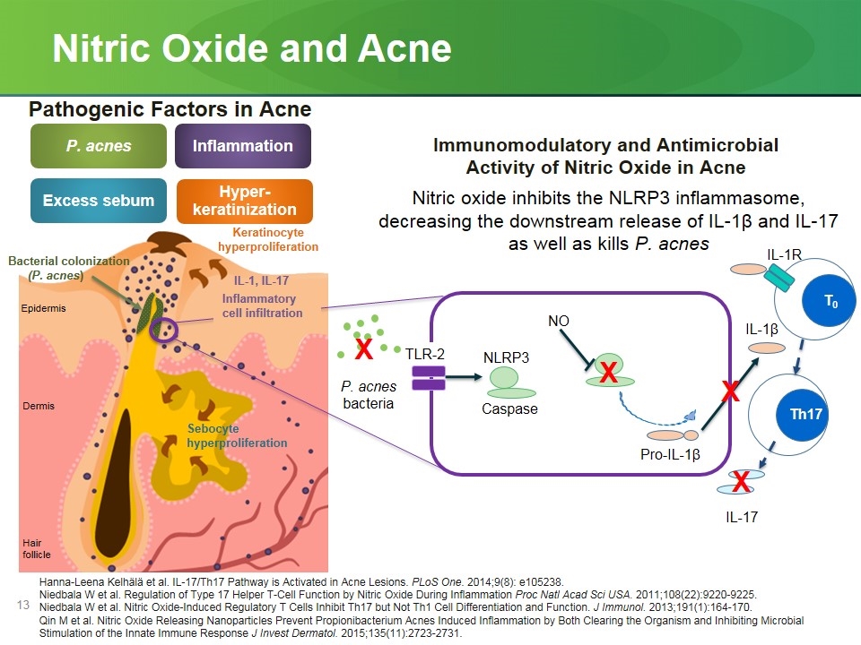 Slide 13