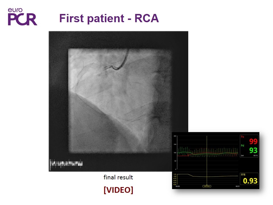 Slide 14