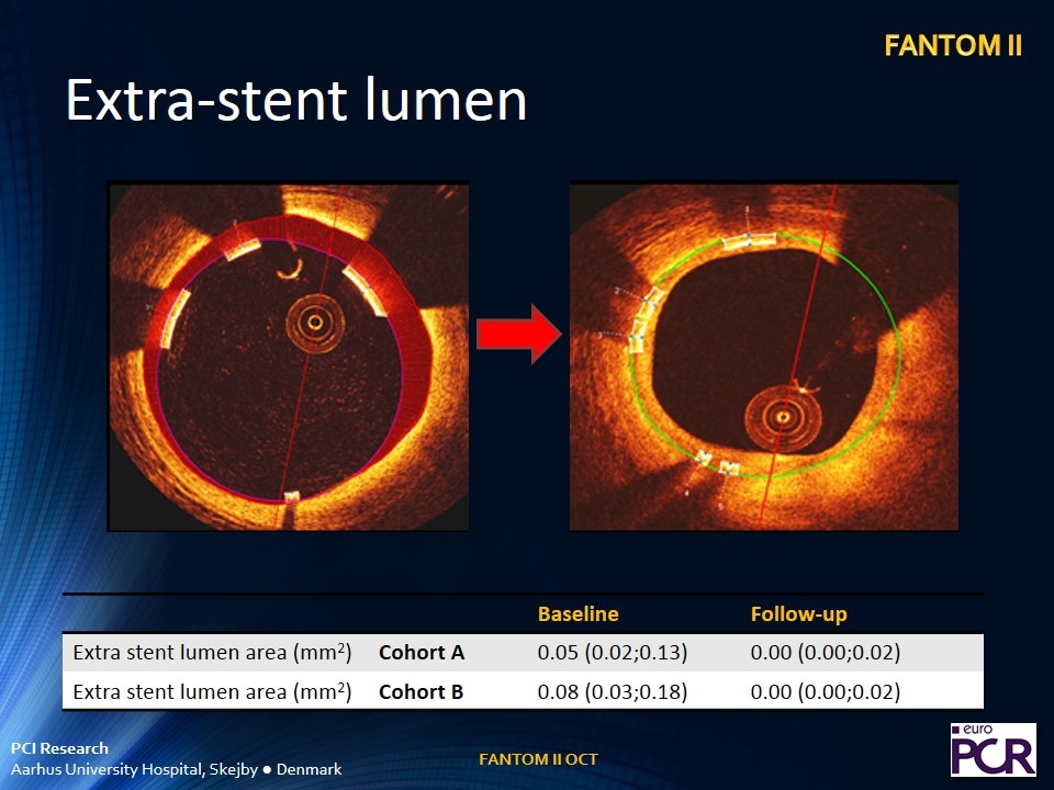 Slide 18