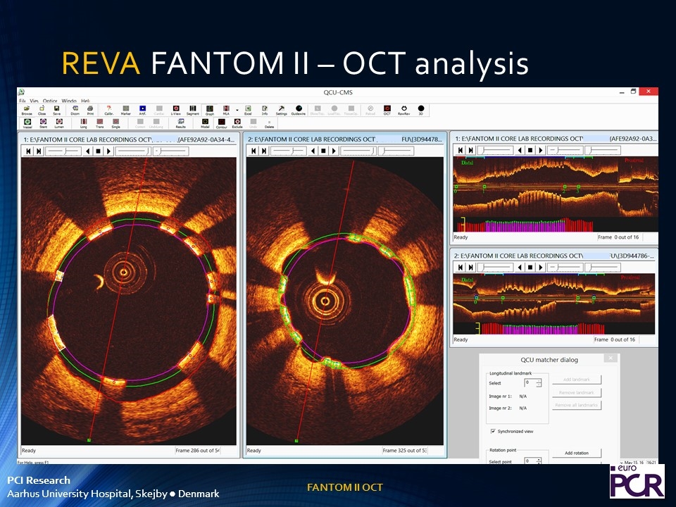 Slide 6