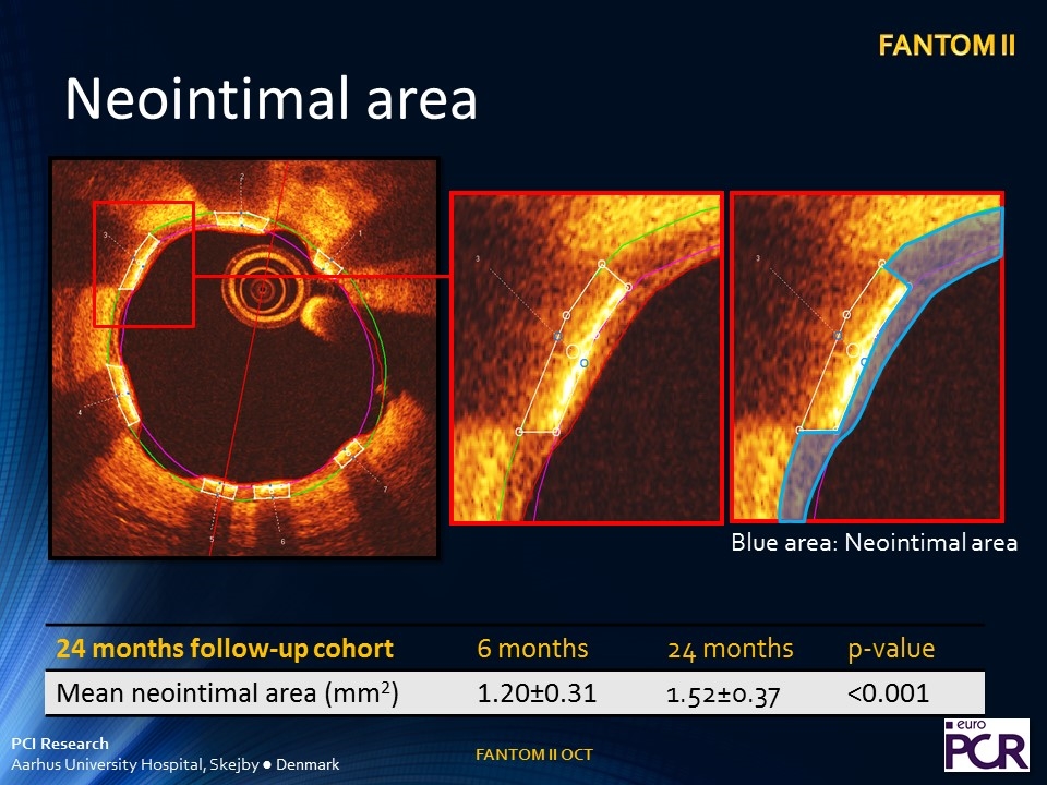 Slide 21