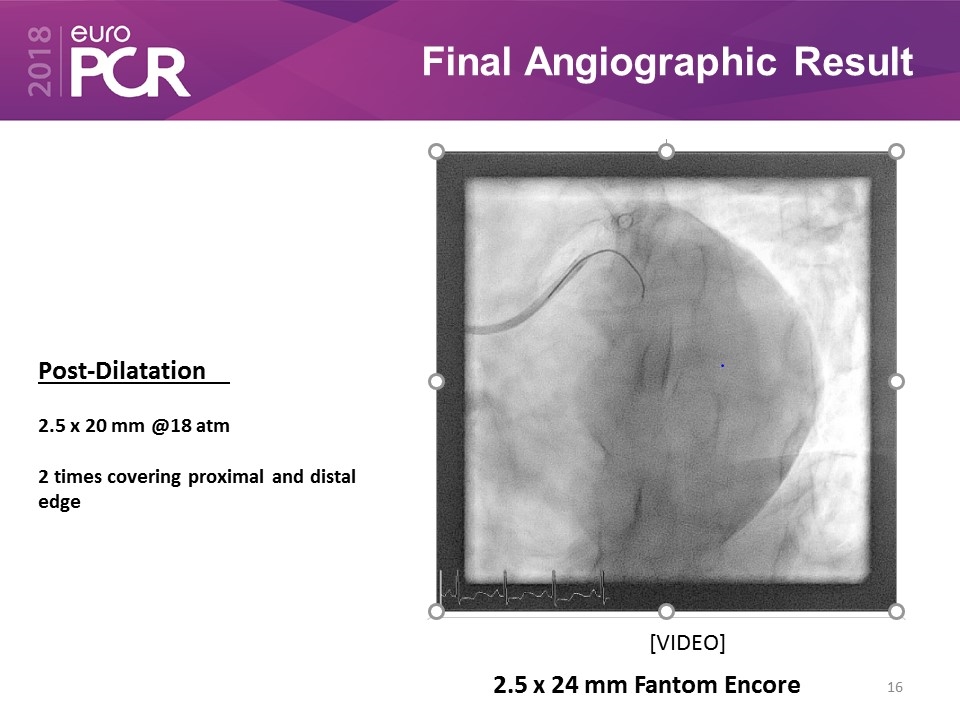 Slide 16