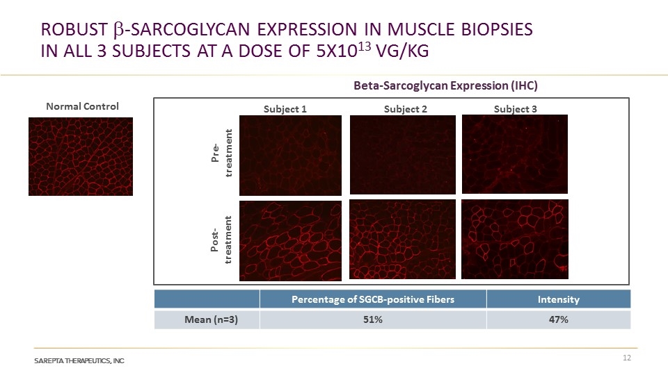 Slide 12