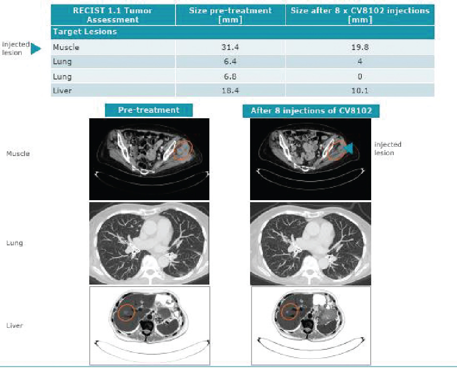 [MISSING IMAGE: tm2036979d1-pht_muscle4clr.jpg]