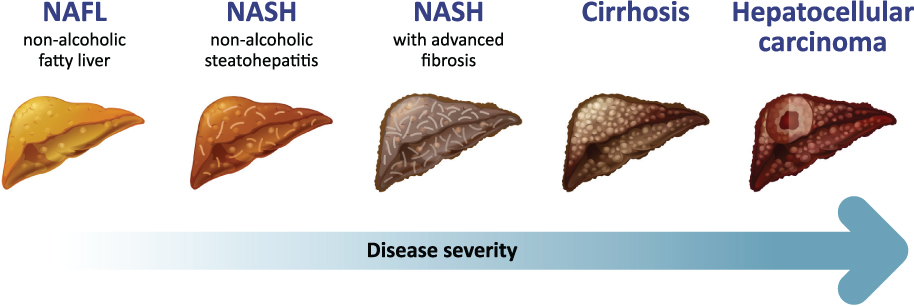 [MISSING IMAGE: tm218447d1-ph_disease4c.jpg]