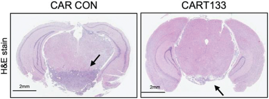 [MISSING IMAGE: tm218551d1-ph_cd133targ4clr.jpg]