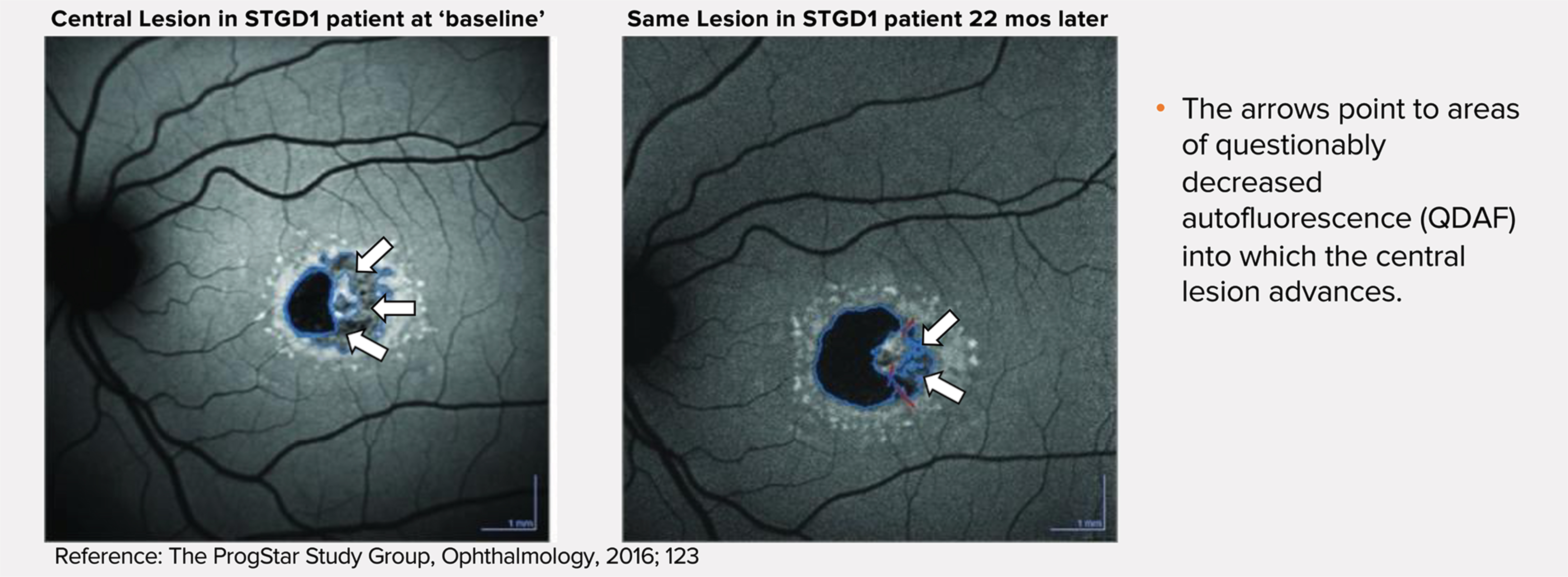 [MISSING IMAGE: tm2132809d10-ph_lesion4c.jpg]