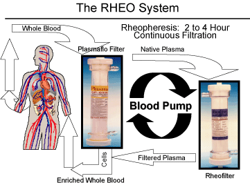(THE RHEO SYSTEM)