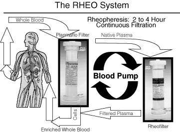 (THE RHEO SYSTEM)