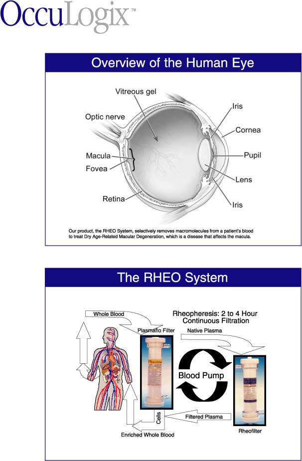 (HUMAN EYE and RHEO SYSTEM)