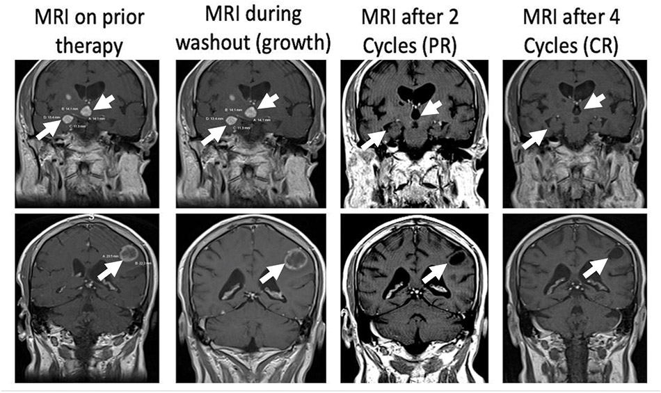 [MISSING IMAGE: ph_mri12week-bw.jpg]