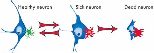 inflamation